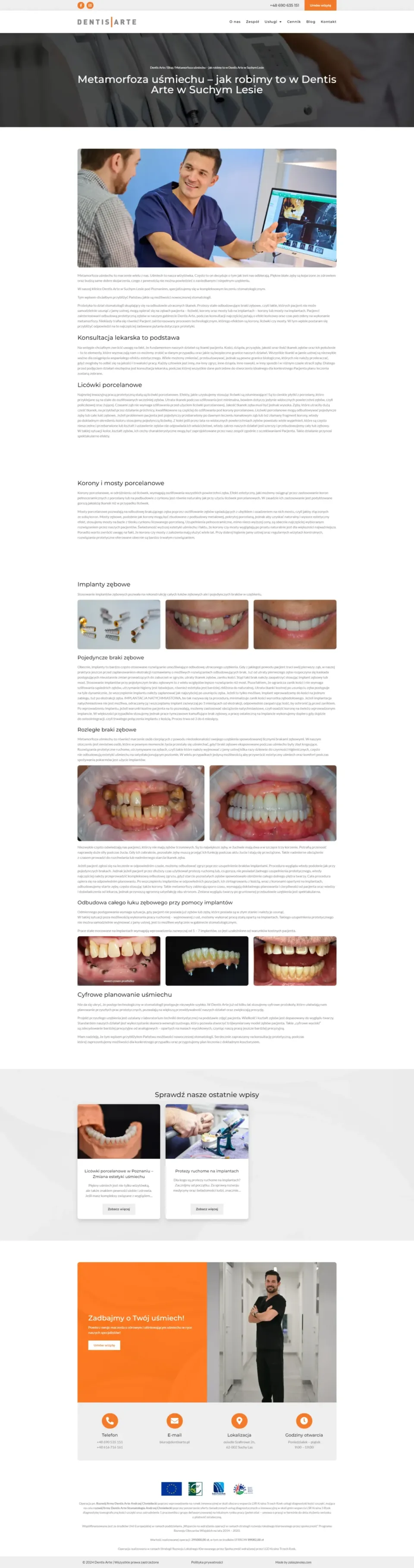 Dentis Arte - strona internetowa: Metamorfoza uśmiechu – jak robimy to w Dentis Arte w Suchym Lesie