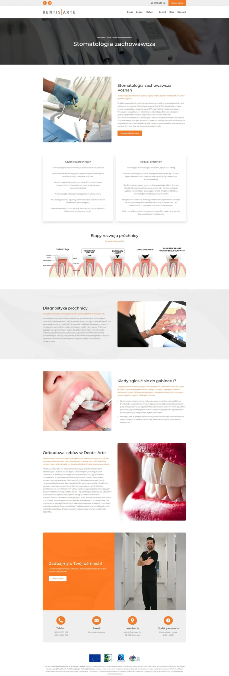 Dentis Arte - strona internetowa: Stomatologia zachowawcza